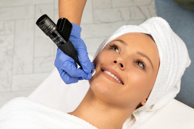 Microchanneling for Sun Damage & Pigmentation